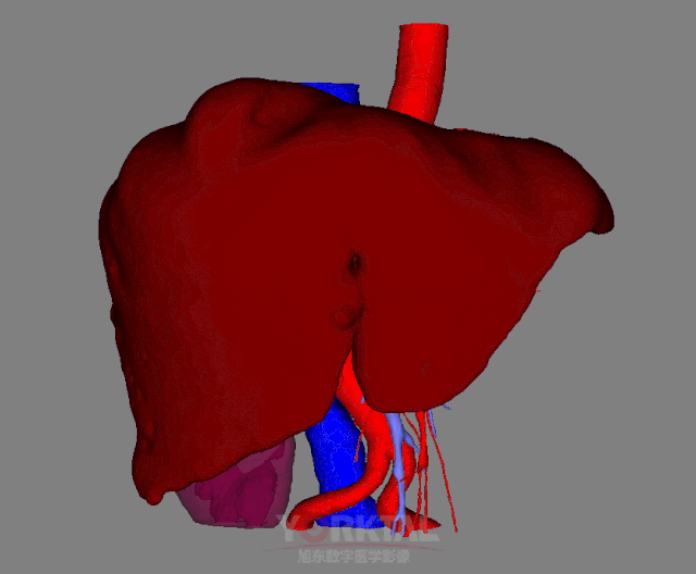 HepaVision Pro liver model preview